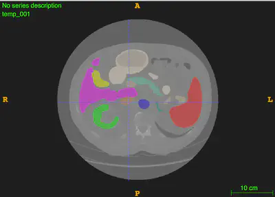 Figure 1: An example of the resulting segmentation of a human abdomen.