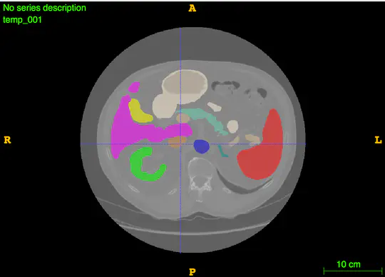 U-Net for Medical Image Segmentation
